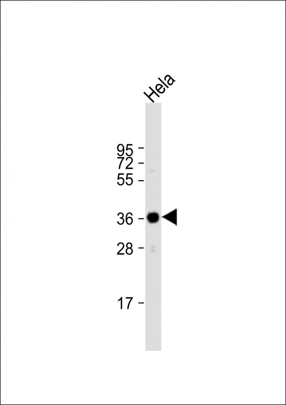 ARPC1A