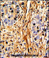 Rabbit Polyclonal Antibody to LAMB2