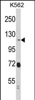 Rabbit Polyclonal Antibody to RASIP1