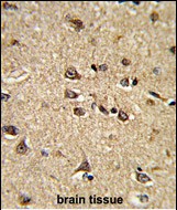 Rabbit Polyclonal Antibody to RASIP1