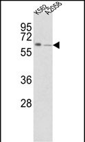 Rabbit Polyclonal Antibody to FPGS