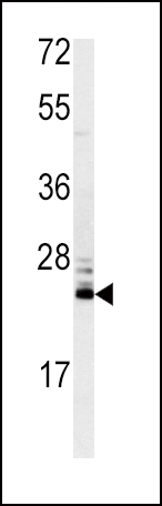 Rabbit Polyclonal Antibody to MSRA (N-term)