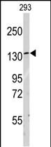 Rabbit Polyclonal Antibody to LARS