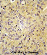 Rabbit Polyclonal Antibody to LARS