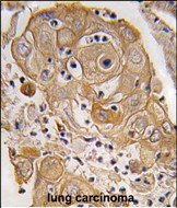 Rabbit Polyclonal Antibody to PTRF (N-term)