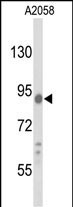 Rabbit Polyclonal Antibody to COG4