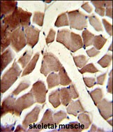 Rabbit Polyclonal Antibody to COG4