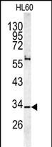 Rabbit Polyclonal Antibody to CAPZA1 (N-term)