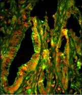 Rabbit Polyclonal Antibody to CAPZA1 (N-term)