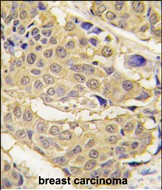 Rabbit Polyclonal Antibody to EPRS (N-term)