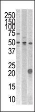 Rabbit Polyclonal Antibody to STYK1 (N-term)