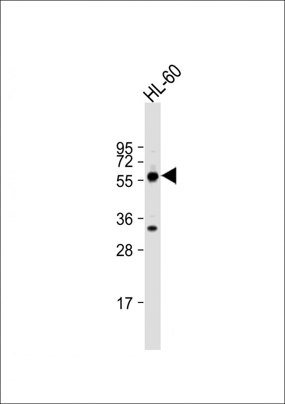 TESK2 (Center C225)