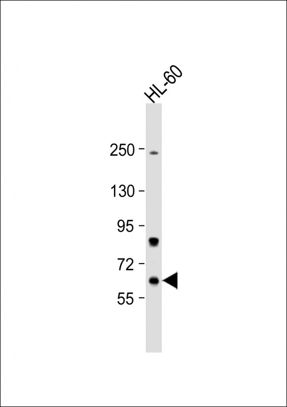 Methionyl tRNA Synthetase