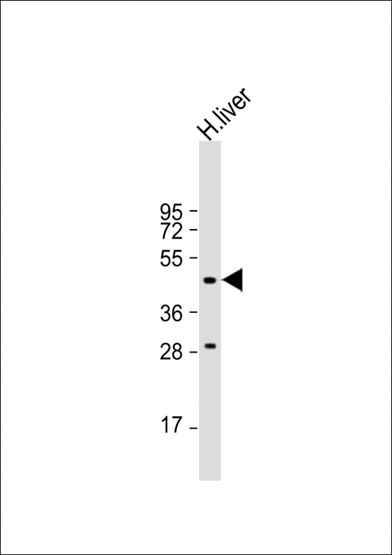 MMAA (N-term)