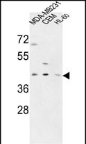 Rabbit Polyclonal Antibody to PR38A  (C-term)