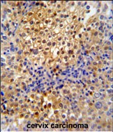 Rabbit Polyclonal Antibody to PR38A  (C-term)