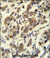 Rabbit Polyclonal Antibody to MBD3L3