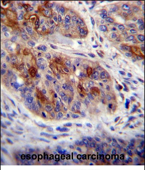 Rabbit Polyclonal Antibody to HAX1
