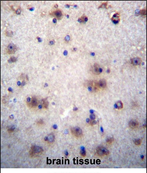 Rabbit Polyclonal Antibody to EVPLL