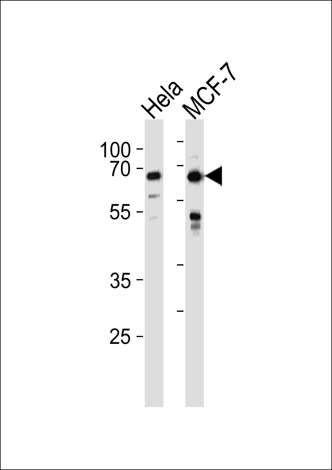 Rabbit Polyclonal Antibody to FOXO3 (N-term)
