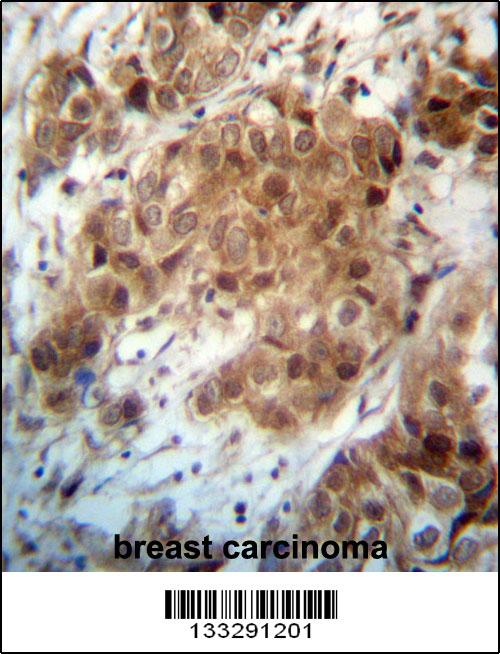 Rabbit Polyclonal Antibody to FOXO3 (N-term)