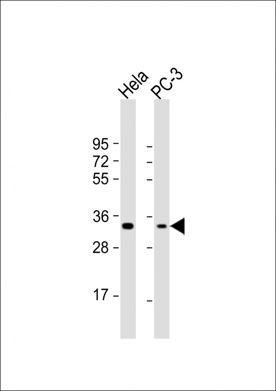 PI15 (N-term)