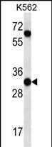 Rabbit Polyclonal Antibody to PI15 (N-term)