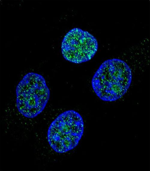 Rabbit Polyclonal Antibody to PROC