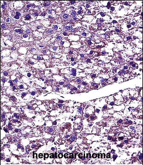 Rabbit Polyclonal Antibody to PROC