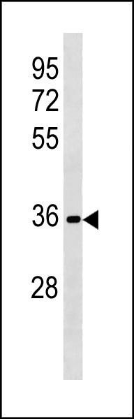 Rabbit Polyclonal Antibody to RFPL3 (N-term)