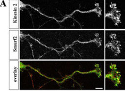 Rabbit Polyclonal Antibody to SMURF2