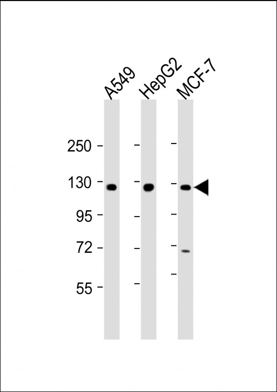 KLB (N-Term)