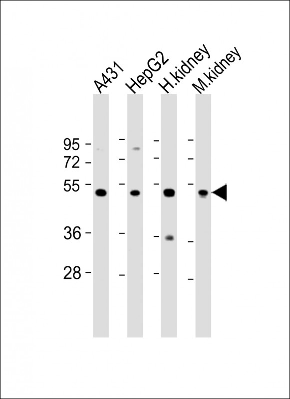 VNN1 (N-Term)