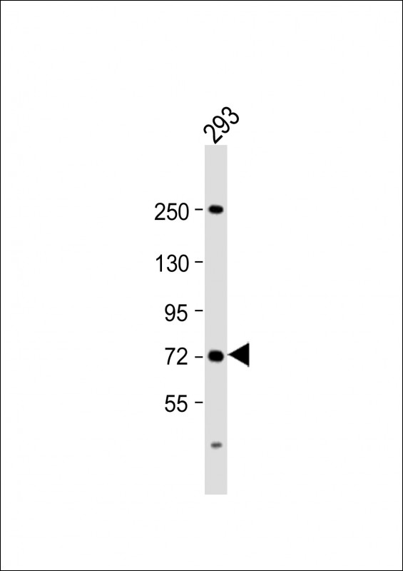 SLC6A19