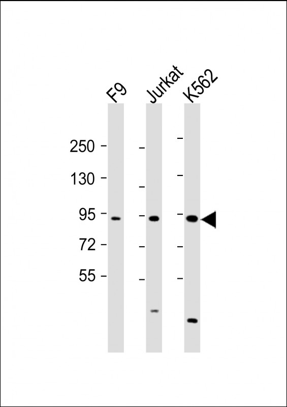 NUP93 (N-Term)