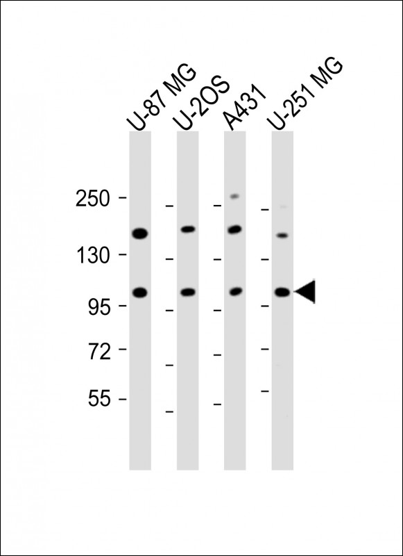 THSD1