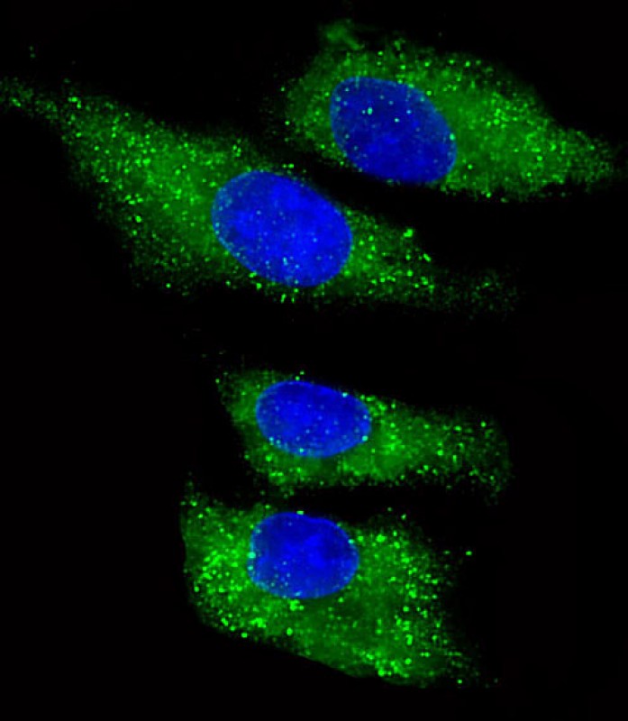 Rabbit Polyclonal Antibody to ITIH4