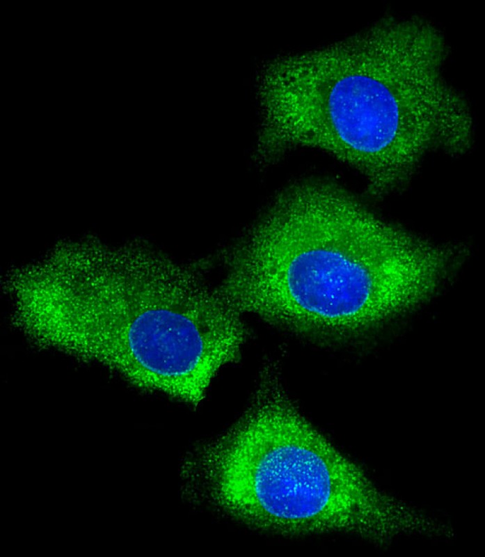 Rabbit Polyclonal Antibody to RPS7