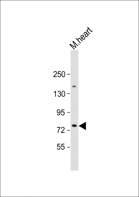 SLC6A8 (N-Term)