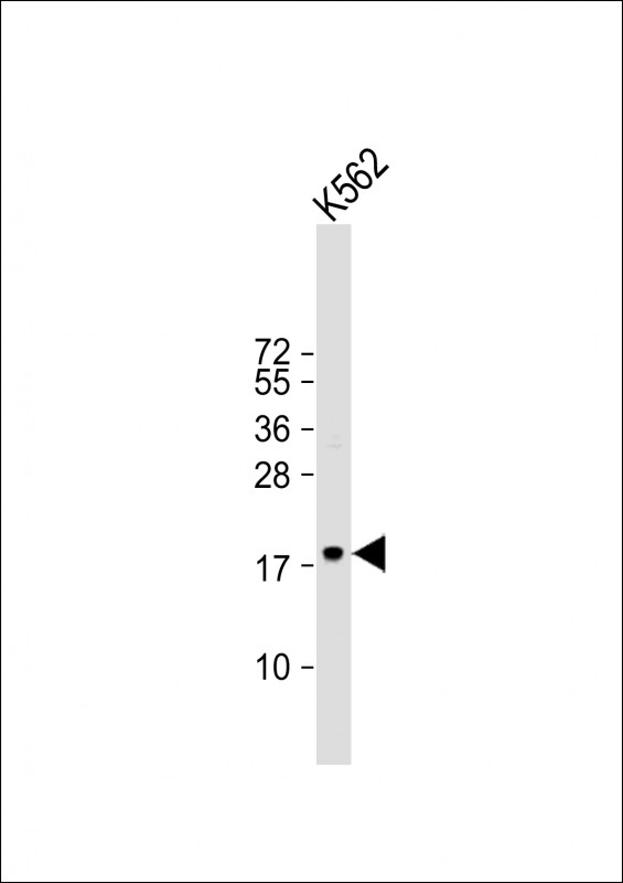 TSPAN2