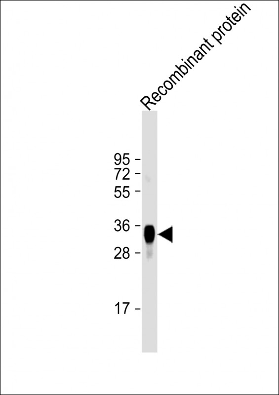 LRP1B