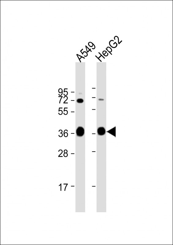 AKR1C3