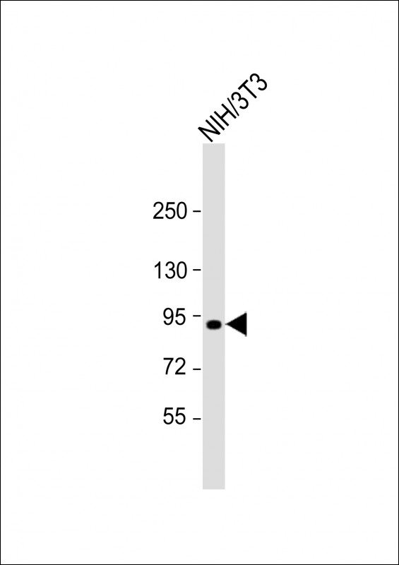 Mouse Eef2k (N-term)