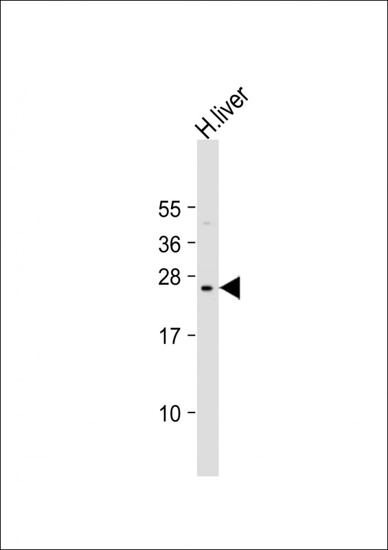 PTTG2