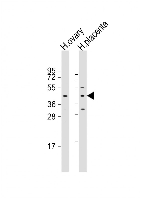 ESX1 (N-term)