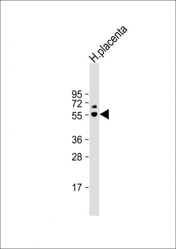 PSG6 (N-term)