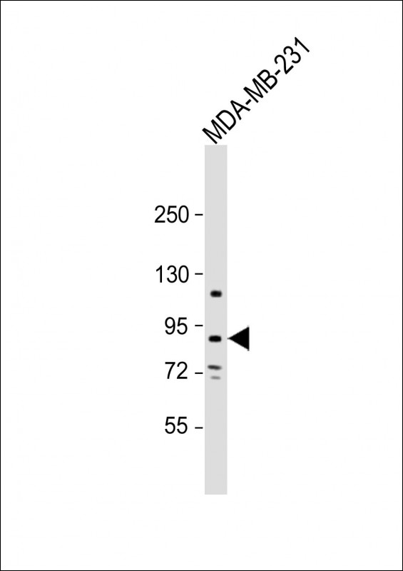 TROAP(N-term)