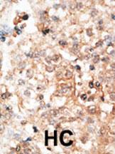 Rabbit Polyclonal Antibody to Osteocalcin (N-term)