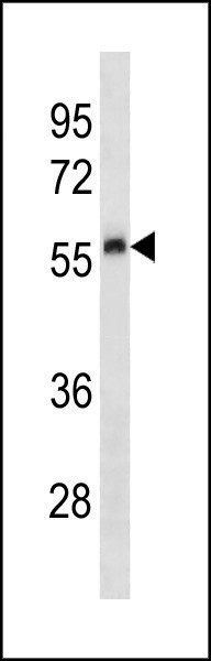 Rabbit Polyclonal Antibody to Mouse Plau