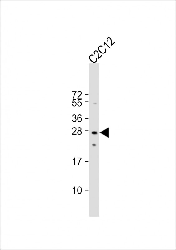 Mouse p27Kip1 (C-term T197)